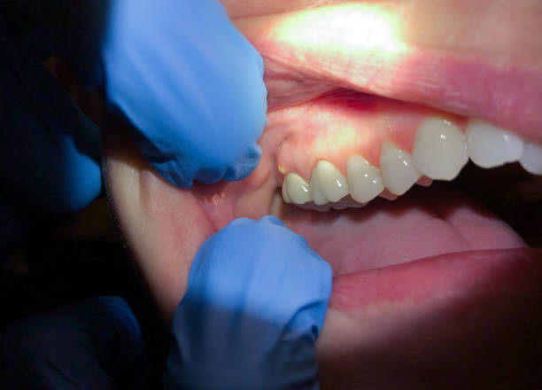 Best Pediatric Emergency Dentist in Phillipsburg, KS
